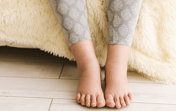 Tips for managing postpartum foot&nbsp;swelling
