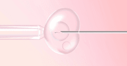 What are my options for assisted&nbsp;conception